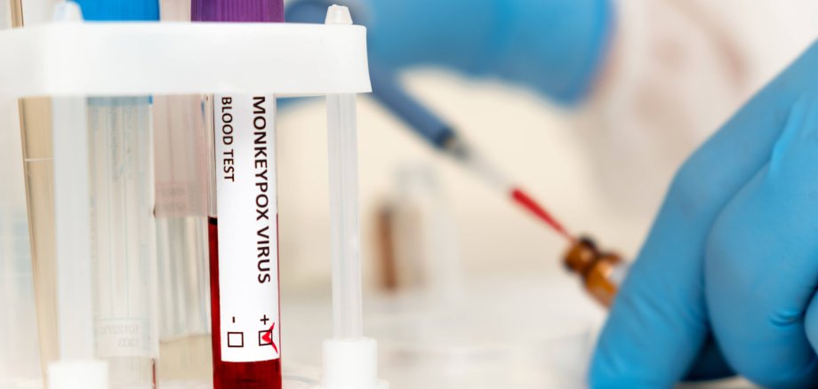 Eine Teströhre mit Blut, das laut Beschriftung mit dem Affenpocken-Virus infiziert ist.